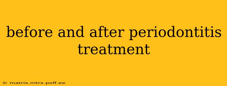 before and after periodontitis treatment