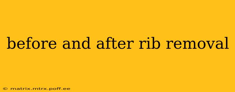 before and after rib removal