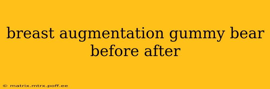 breast augmentation gummy bear before after