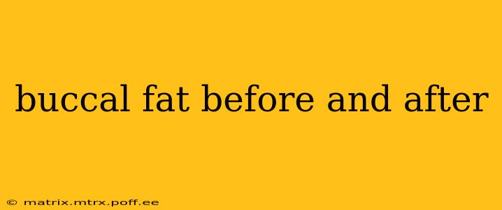 buccal fat before and after