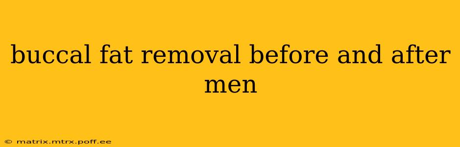buccal fat removal before and after men