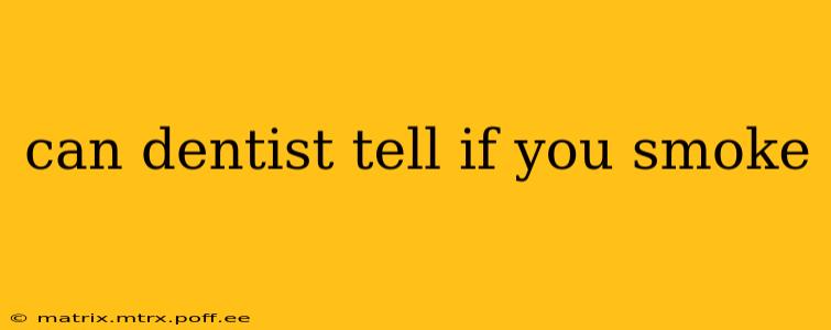 can dentist tell if you smoke