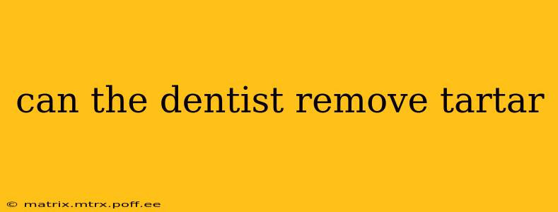 can the dentist remove tartar