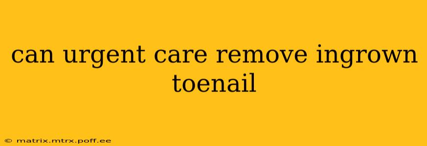 can urgent care remove ingrown toenail