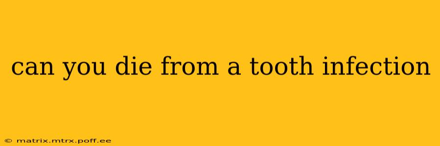 can you die from a tooth infection