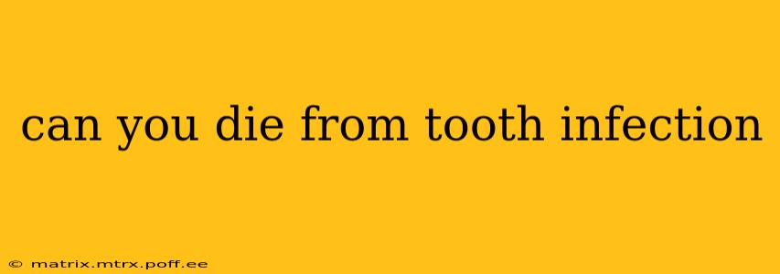 can you die from tooth infection
