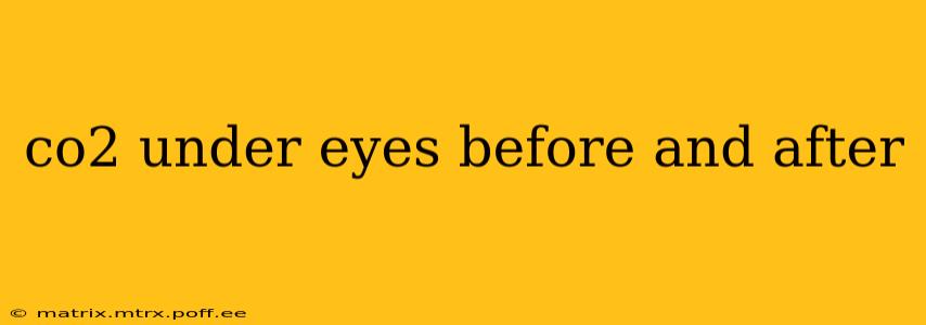 co2 under eyes before and after