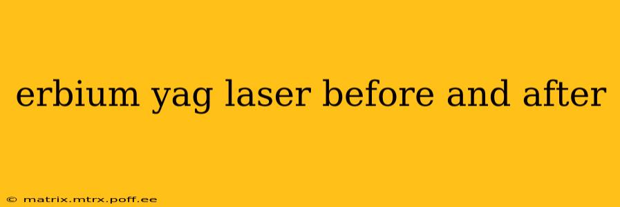 erbium yag laser before and after