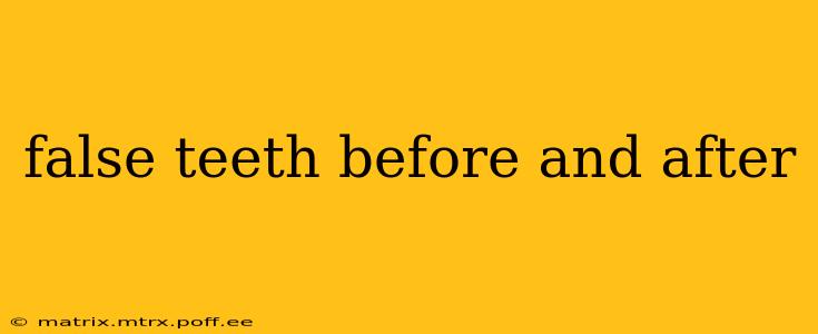 false teeth before and after