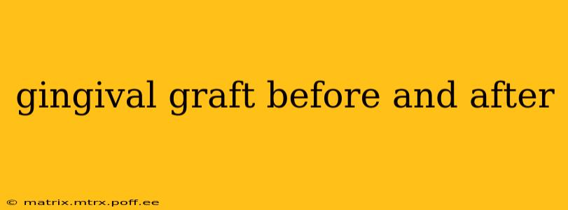 gingival graft before and after