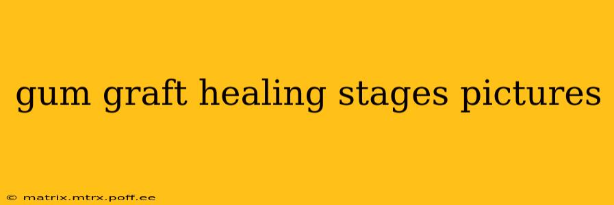 gum graft healing stages pictures