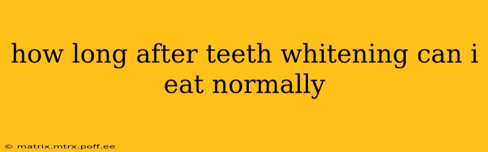how long after teeth whitening can i eat normally
