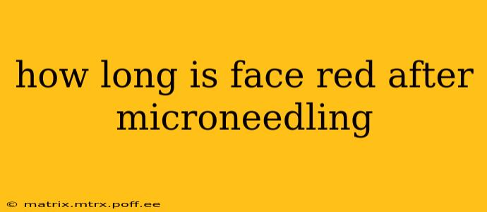 how long is face red after microneedling