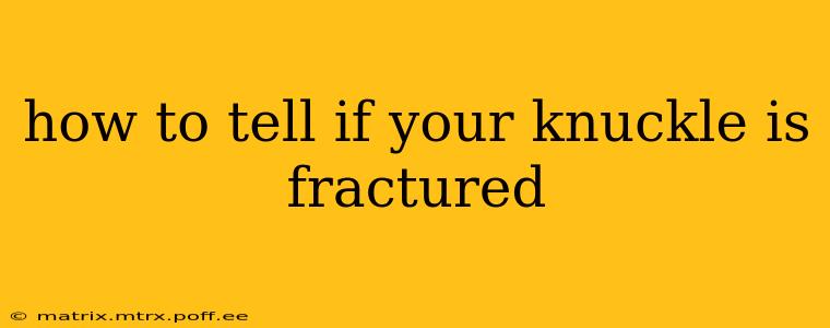 how to tell if your knuckle is fractured