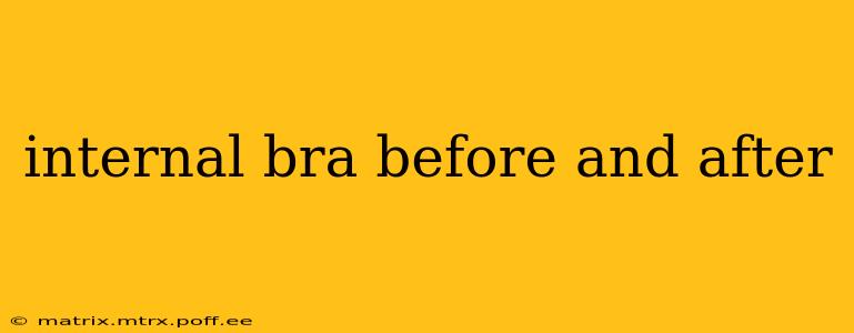 internal bra before and after