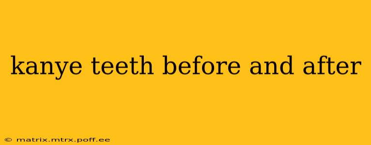 kanye teeth before and after