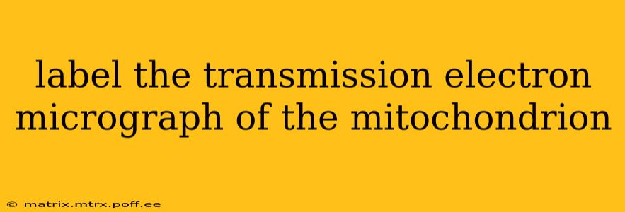 label the transmission electron micrograph of the mitochondrion