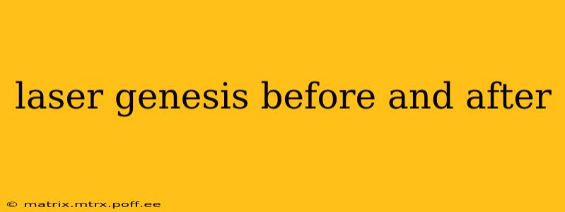laser genesis before and after