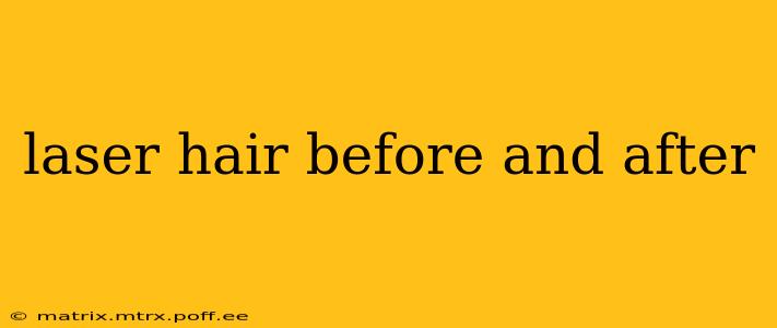 laser hair before and after