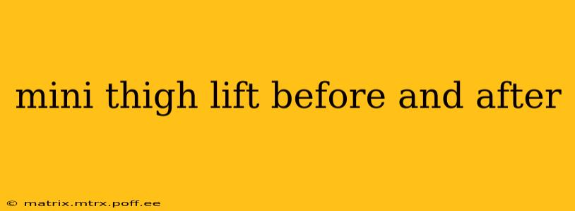 mini thigh lift before and after