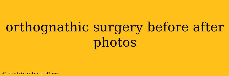 orthognathic surgery before after photos