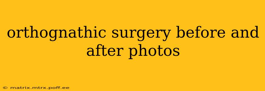 orthognathic surgery before and after photos