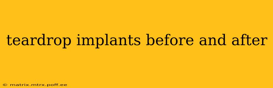 teardrop implants before and after