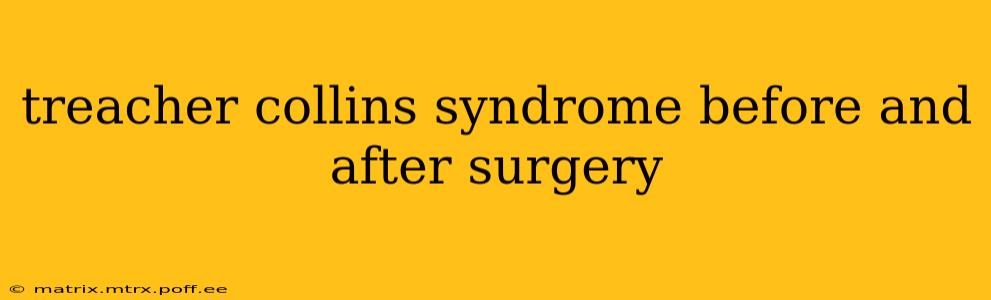 treacher collins syndrome before and after surgery