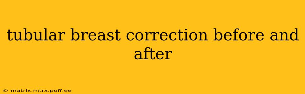 tubular breast correction before and after