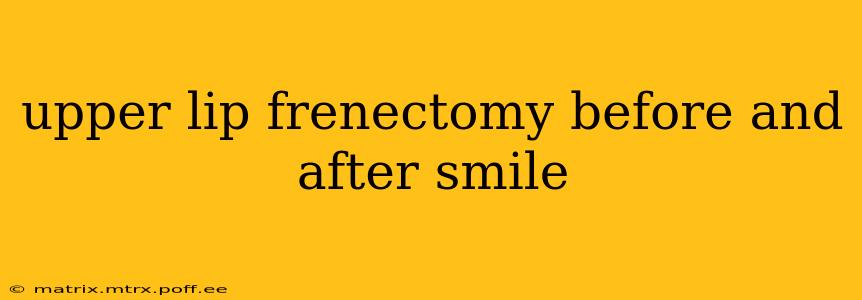 upper lip frenectomy before and after smile