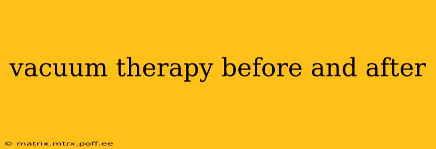 vacuum therapy before and after