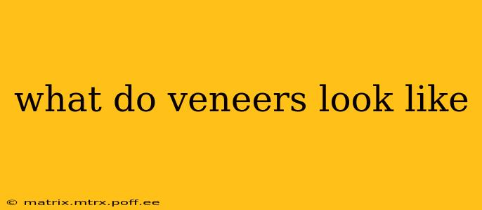 what do veneers look like