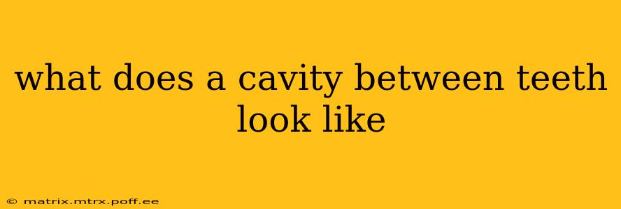 what does a cavity between teeth look like