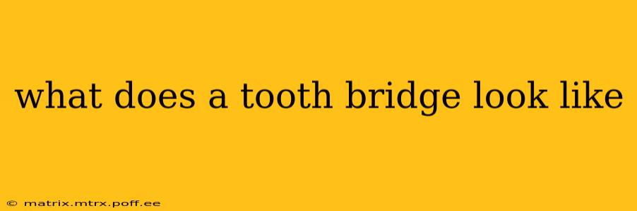 what does a tooth bridge look like