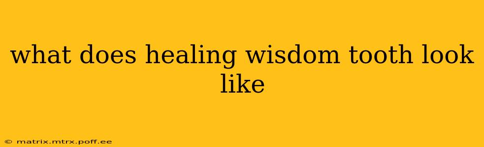 what does healing wisdom tooth look like
