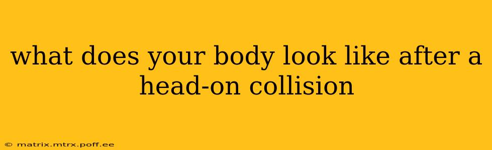 what does your body look like after a head-on collision