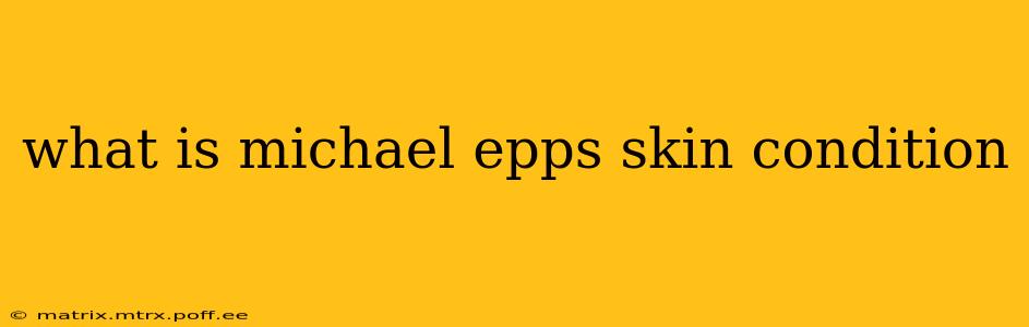 what is michael epps skin condition